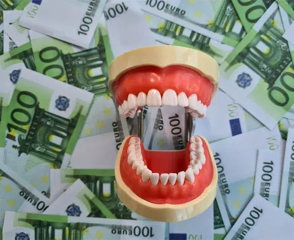 Was kostet eine professionelle Zahnreinigung in Berlin